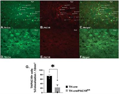 The role of pituitary adenylate cyclase-activating polypeptide neurons in the hypothalamic ventromedial nucleus and the cognate PAC1 receptor in the regulation of hedonic feeding